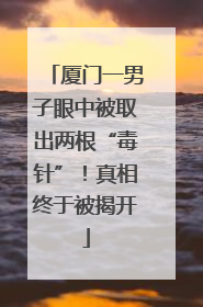 厦门一男子眼中被取出两根“毒针”！真相终于被揭开
